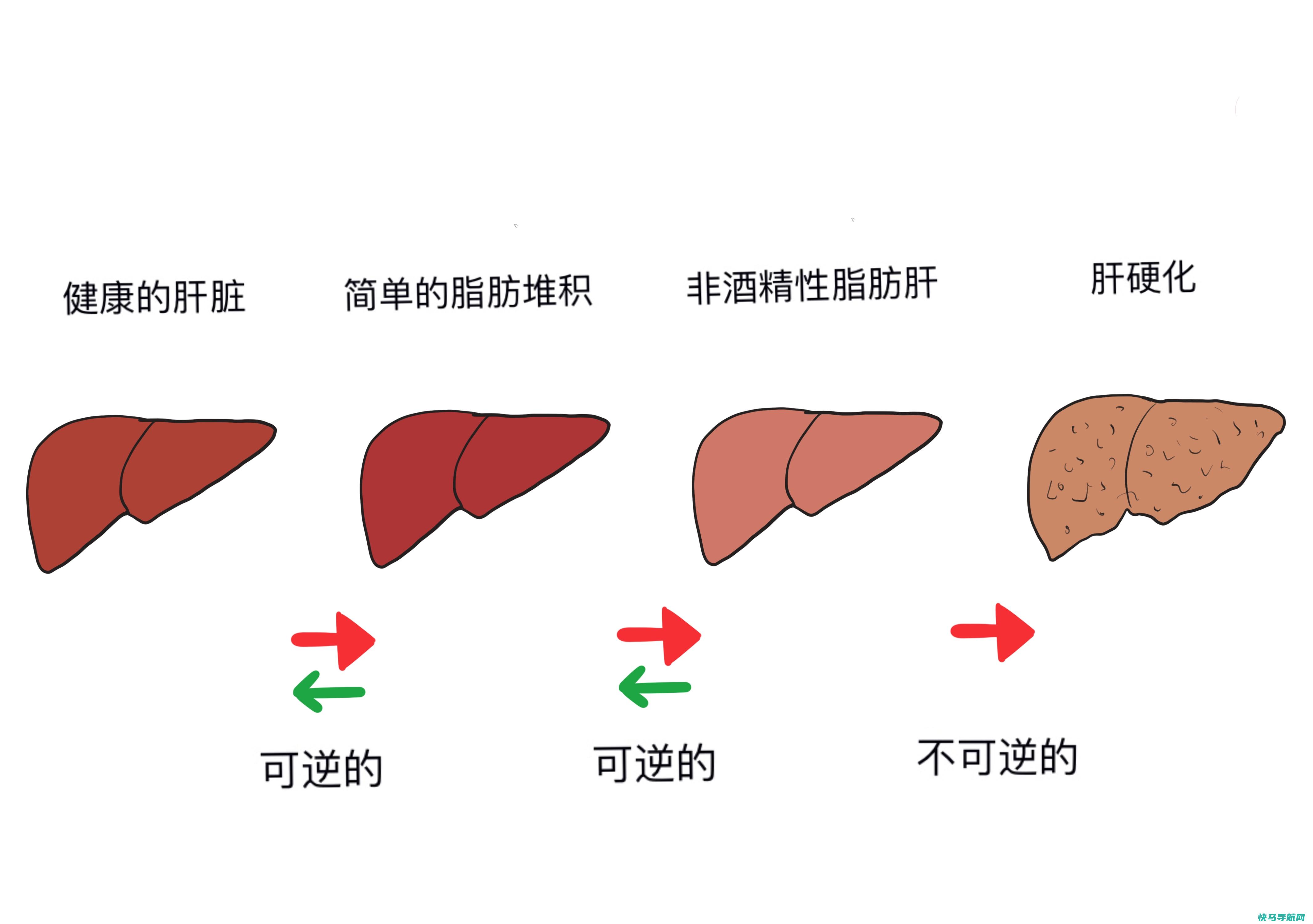 如何治疗乙肝病